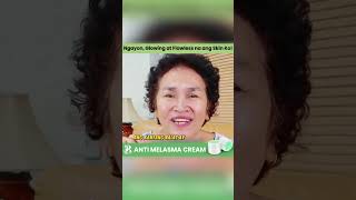 Melasma Cream  40 Off Sale [upl. by Chantalle]