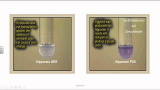 Group B Streptococci or Streptococcus Agalactia [upl. by Cerveny]