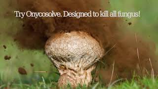 OnycoSolve  Designed To Kill All Fungus [upl. by Nyleahcim667]