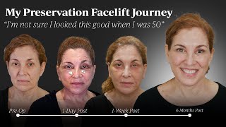 Lorries Preservation Facelift Journey  Dr Kevin Sadati [upl. by Bernardo944]