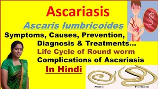 Ascariasis  Ascaris Lumbricoides  Symptoms Causes Diagnosis Treatment  Roundworm life cycle [upl. by Annovahs]