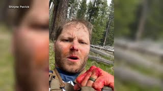 Veteran speaks out after fighting off grizzly bear while on honeymoon [upl. by Ahtilat]