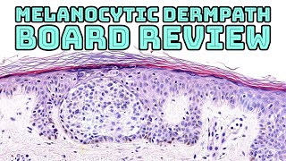 Melanocytic Dermpath Board Review melanoma blue nevus other nevi amp mimics pathology dermatology [upl. by Aynotal]