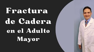 FRACTURA DE CADERA DEL ADULTO MAYOR [upl. by Venator]