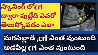 gender prediction used Crl length Crl measurements in pregnancy scanning crl values [upl. by Nagol]