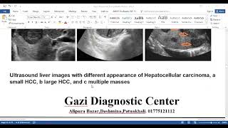 Ultrasonography report analysis [upl. by Flatto]