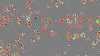 Essen BioScience CellPlayer Kinetic Cytotoxicity Assay [upl. by Sad382]