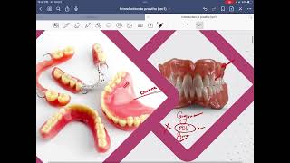 Introduction to prosthodontics [upl. by Fauman]