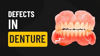 Defects In Denture  properties of Denture Base Materials [upl. by Naujal523]