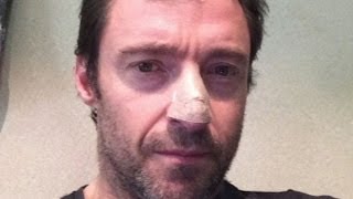 Hugh Jackman Reveals Skin Cancer Diagnosis [upl. by Folger275]