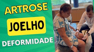 DEFORMIDADE NO JOELHO  ARTROSE HÃ MAIS DE 26 ANOS  artrose joelho fisioterapia acupuntura [upl. by Layney190]