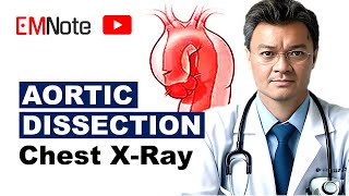 Aortic Dissection Radiographic Findings [upl. by Auqeenahs128]