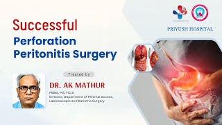 Successfully Perforation Peritonitis Surgery by Laparoscopic Surgeon Dr AK Mathur [upl. by Percival460]