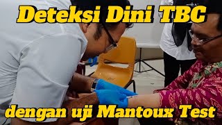 AYO DETEKSI DINI TBC DENGAN MANTOUX TEST SEMUANYA SUDAH DITES HASILNYA NEGATIF [upl. by Kant325]