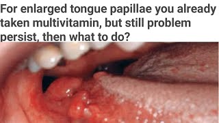 Tongue papillae enlarges you had taken multivitamin but not relieved yet then what are causes [upl. by Otsuj]