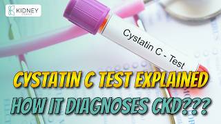 Serum Cystatin C Test To Diagnose Chronic Kidney Disease  CKD Testing [upl. by Ahoufe]