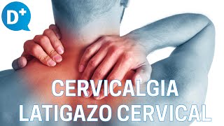 Causas y tratamiento de la cervicalgia y del latigazo cervical [upl. by Donald]