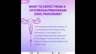 Hysterosalpingogram procedure [upl. by Nahtnoj]