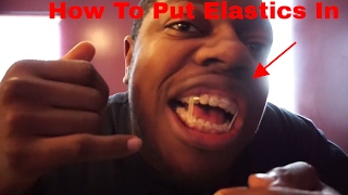 HOW TO Put ElasticsBands In For Braces Feat My Secret Twin [upl. by Yehtomit763]