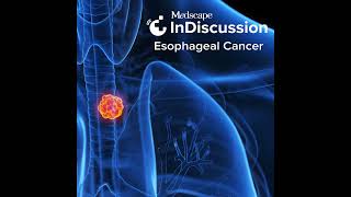 Emerging Biomarkers and Novel Therapies for Esophageal Cancer [upl. by Ennairod662]