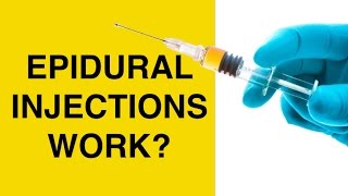 Epidural Injections for Back Pain and Sciatica  Cortisone Steroid Shots for Herniated Discs [upl. by Hcurob461]