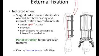 Orthopaedic trauma for med students 2 [upl. by Yalc13]