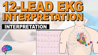 The SIMPLE Steps of 12Lead EKG Interpretation  EXPLAINED CLEARLY [upl. by Bastien860]