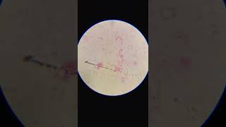 bacteria azotobacter under a microscope science biology [upl. by Hugibert789]