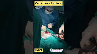 Collar bone fracture Surgery [upl. by Nellaf]