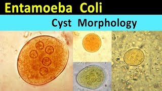 Entamoeba Coli Cyst Morphology [upl. by Dilly836]