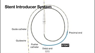 HCC 1474 17d Biliary Plastic Stents Using a Stent Introducer System [upl. by Marba]