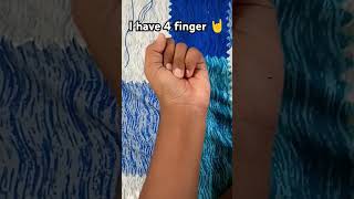 I have 4 finger 🤘 shorts ytshorts [upl. by Schonfeld]