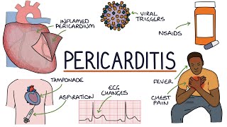 Understanding Pericarditis [upl. by Kassab]