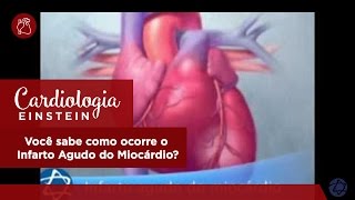 Você sabe como ocorre o Infarto Agudo do Miocárdio [upl. by Eirotal]