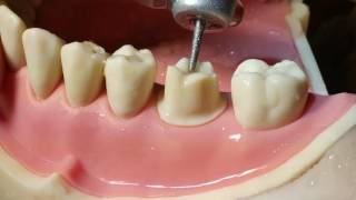 Molar Crown Preparation Walkthrough tutorial in the Simulation Lab [upl. by Yonina]