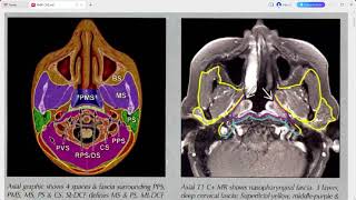 RADIOLOGY EXAM CASES [upl. by Yelsnit]