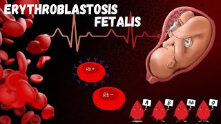 228 Erythroblastosis Foetalis  Maternal Foetal Rh Incompatibility  Class 12  Biology [upl. by Euqininod158]