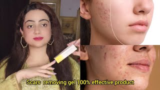 Acne scars removal Gel  contractubex Gel beauty facts acnescars scars pimples [upl. by Nnairb]