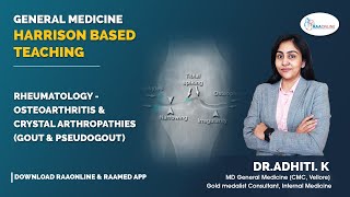 HBT  Rheumatology  Osteoarthritis and crystal arthropathies Gout and Pseudogout  Raaonline [upl. by Willner]