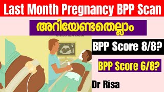 9 month Pregnancy ScanLast Month Pregnancy ScanWhat is BPP score [upl. by Lellih]