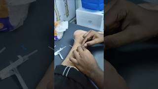 Dry Needling fr Ankle Sprain acupuncture fitness doctor health physiotherapist painrelief [upl. by Antoine]