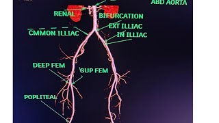 CT Lower Limb Angiography Anatomy CT scanPost processing avnishradiologypart1 [upl. by Madriene]