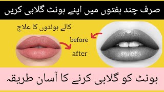 How to get soft simple lips  Home remedy for pink lips in 5 minutes  Pink lips [upl. by Whitnell]