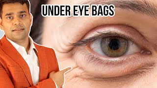 Under Eye Home Remedy  Remove Under Eye Bags Completely  Remove Dark Circle Wrinkles Puffy Eyes [upl. by Mairhpe]