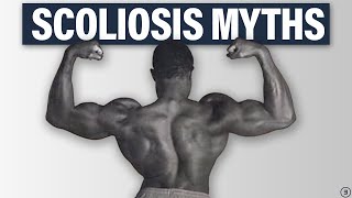 5 Facts You NEED to Know About Scoliosis Best Exercises Back Pain Performance and More [upl. by Eiliak]