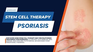 Psoriasis Sufferers Rejoice Stem Cell Therapy is Changing the Game [upl. by Ultan910]