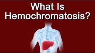 What Is Hemochromatosis [upl. by Ennove]