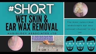 EAR WAX REMOVAL Shorts [upl. by Ahter4]