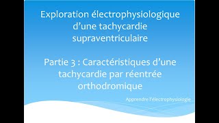 Exploration électrophysiologique dune TSV Partie 3 Tachycardie par réentrée orthodromique [upl. by Narton]