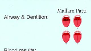 Preoperative anaesthetic assessment [upl. by Havener847]